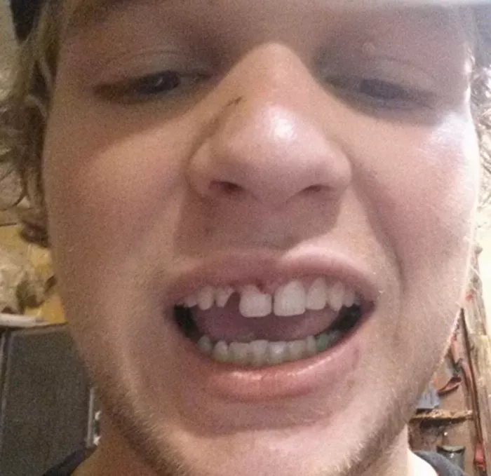 Jamie Foy's smiling face, showing teeth